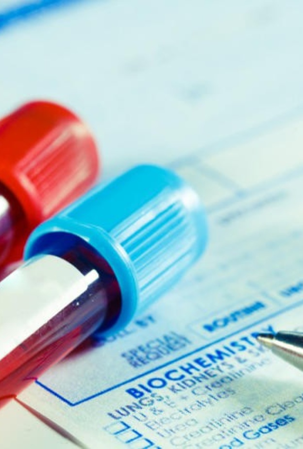 ارتفاع قلوية الدم يسبب أعراض خطيرة على الصحة