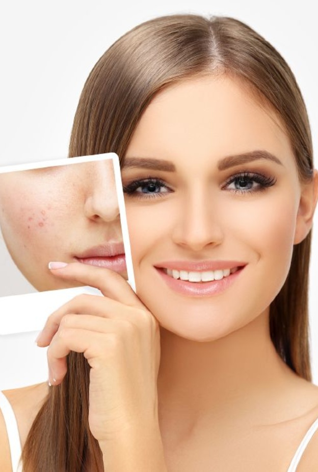 فوائد خل التفاح للعناية بالجسم والبشرة