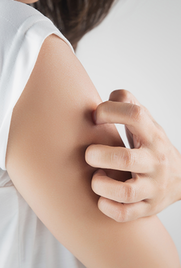 حساسية الطعام تسبب حكة في الجلد