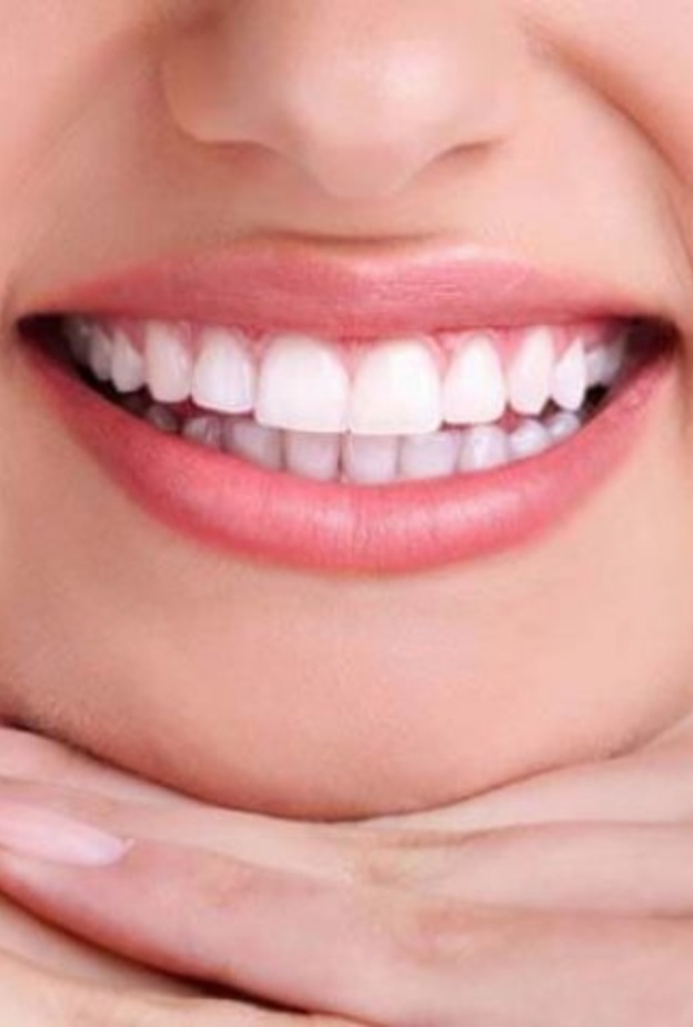 الابتسامة اللثوية لها تأثير سلبي على جمالية ابتسامتك