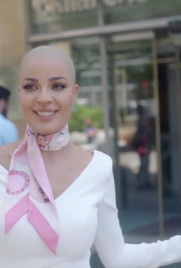 نجوم لم يكترثوا بفقداتهم جزءا من جمالهم في مسلسلات رمضان 2019