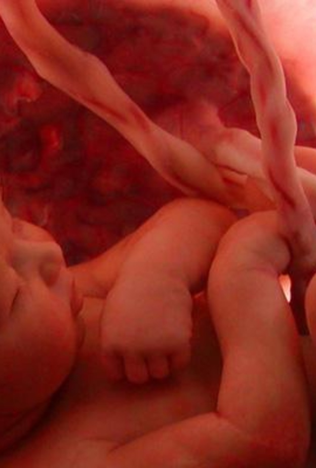 أسباب إلتفاف الحبل السري حول عنق الجنين