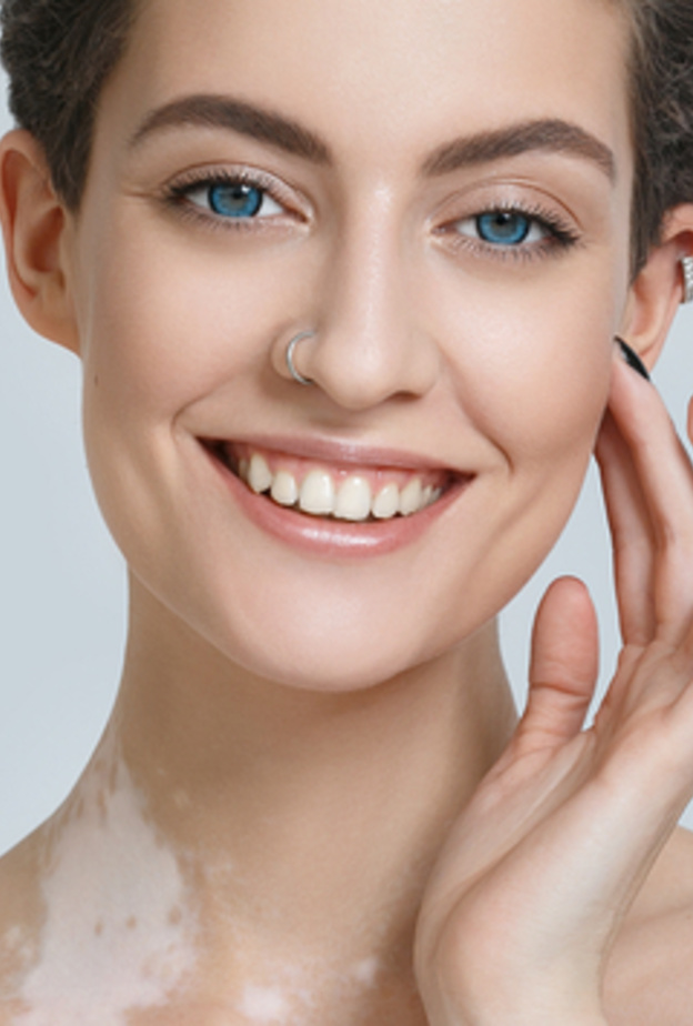  مرض المهق يسبب تغير في لون الجلد