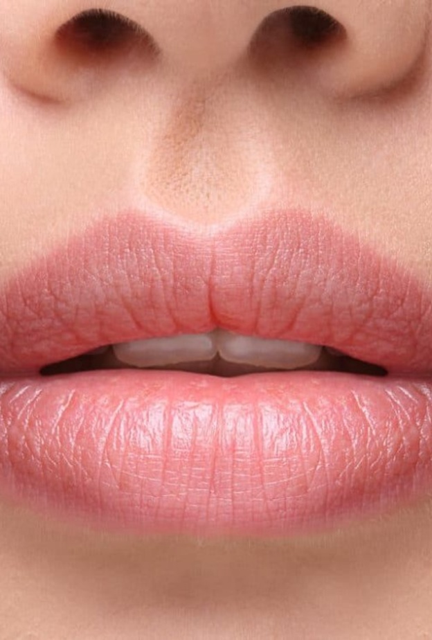 الفم الواسع هو عندما يكون فيه الطول الأفقي للفم من زاوية إلى أخرى طويلاً أو واسعاً