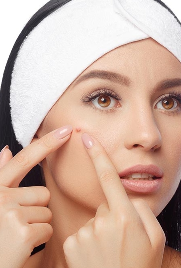 ابتعدي عن الادوية لعلاج حب الشباب