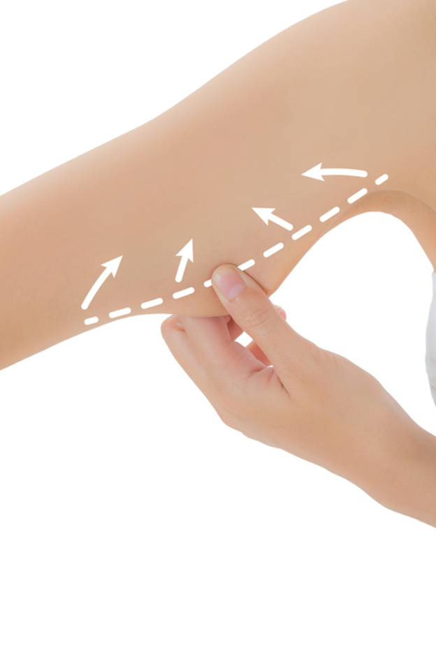 تخلصي من السيلوليت من خلال تقنية الليزر أو تقنية سيلفينا