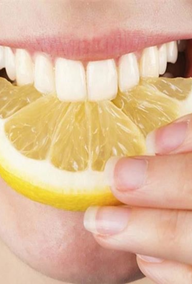 الإفراط في تناول الليمون يسبب حصوات الكلى