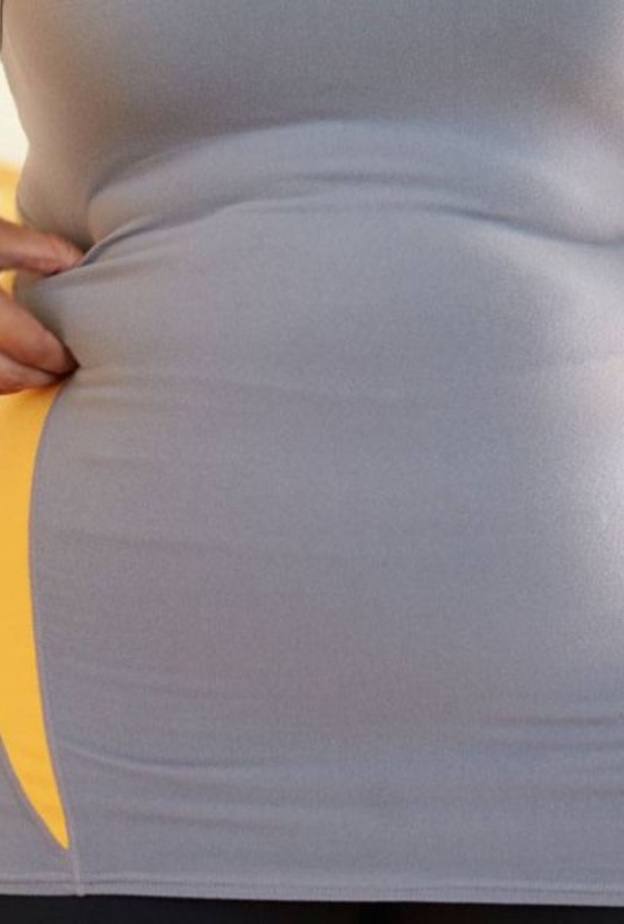 اخضعي لعملية شد الذراع التي يتم من خلالها إزالة الجلد الزائد من الذراعين العلويين