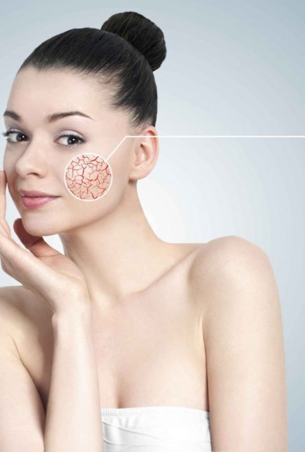 خلطات طبييعية لازالة اثار الحروق القديمة