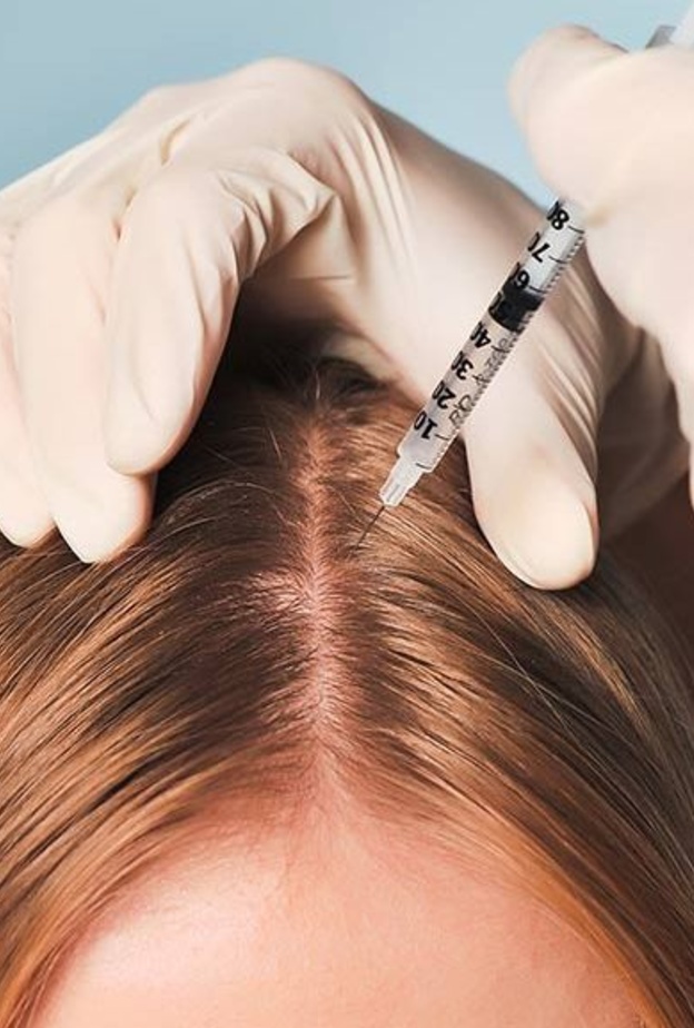 فيلر الشعر هو أحدث شكل من أشكال العناية بالشعر