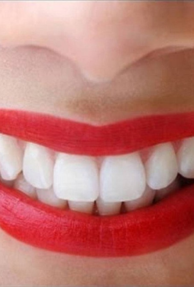 الأطعمة الغنية بالكالسيوم مهمة لصحة الفم