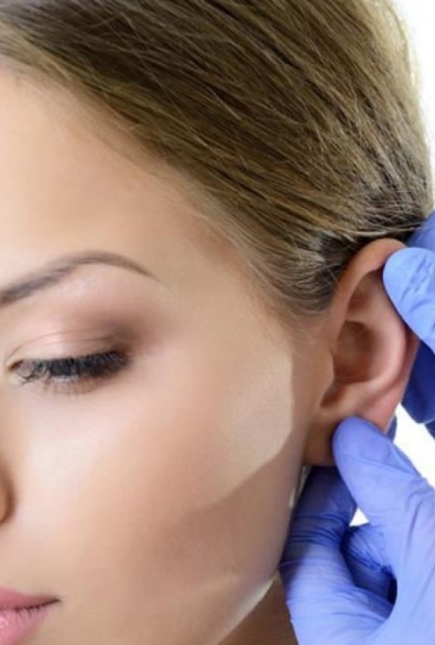 جئي لعملية تجميل الأذن إذا كنت تعانين من الآذان الخفاشية