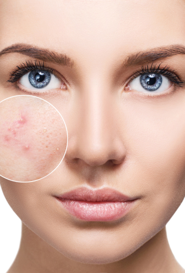 احرصي على ترطيب بشرتك للحفاظ على نضارتها ليلاً