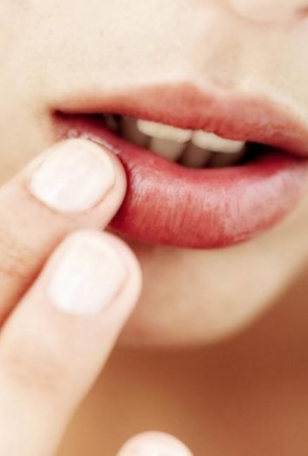 سرطان الفم يسبب ألم وتقرحات لا تلتئم