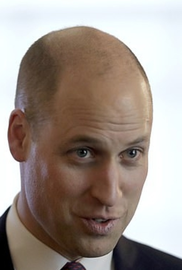 إصابة الأمير وليام بالصلع سببت أزمة لمصممي العملات التذكارية التي تحمل صوره