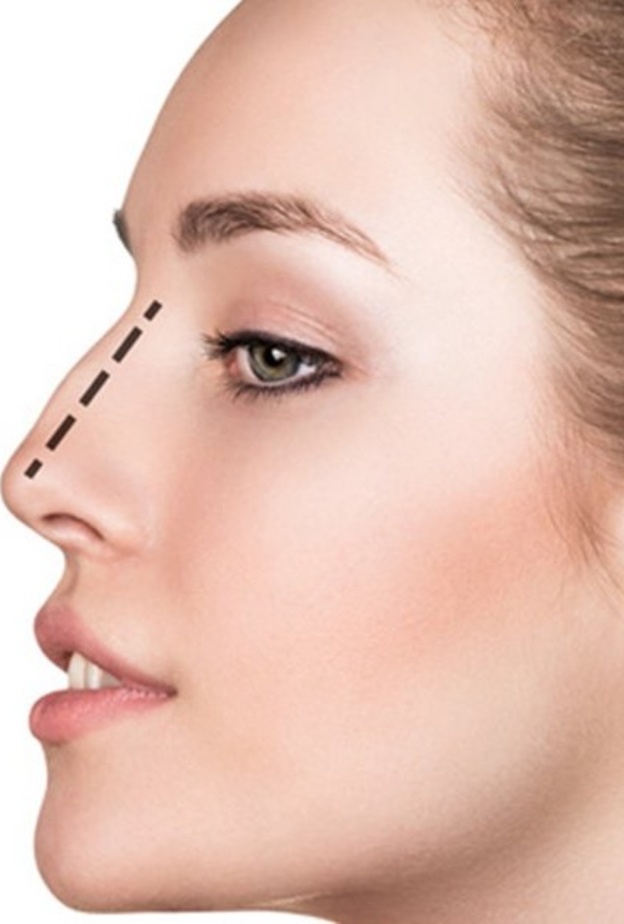 احصلي على أنف صغير مثالي من خلال خضوعك لعملية تصغير عظمة الأنف