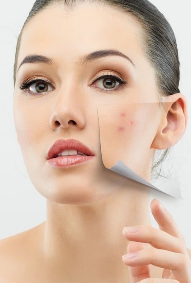 التصبغ الجلدي هو تراكم الخلايا الصباغية تحت الجلد