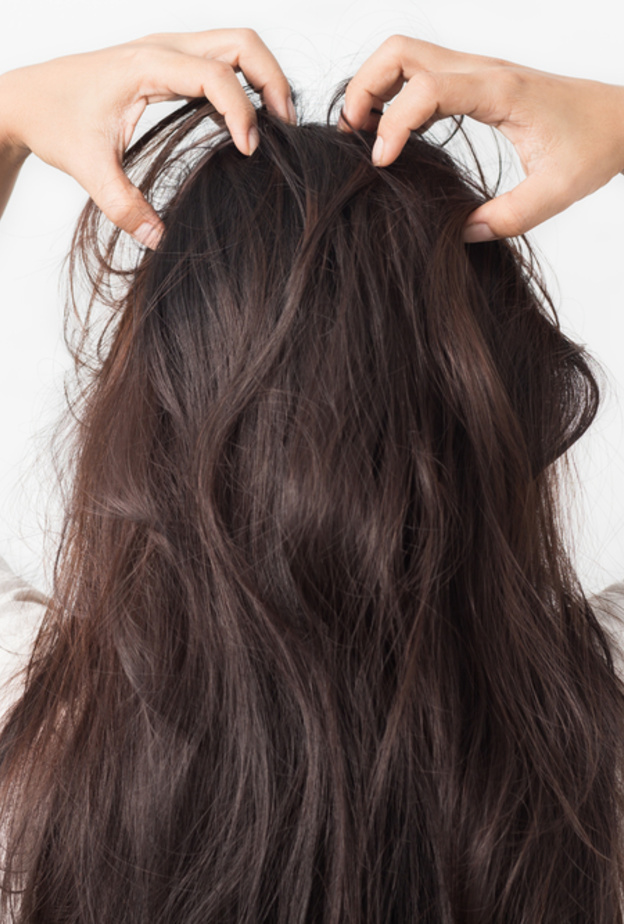 تجنبي تراكم الجلد الميتة لتجنب حكة فروة الرأس