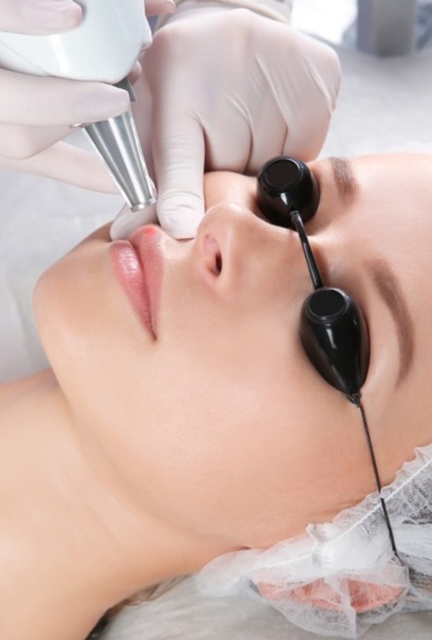  توريد الشفايف بالليزر