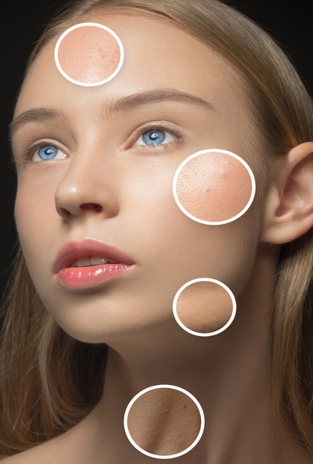  البشرة الدهنية تساعد على تأخير علامات الشيخوخة