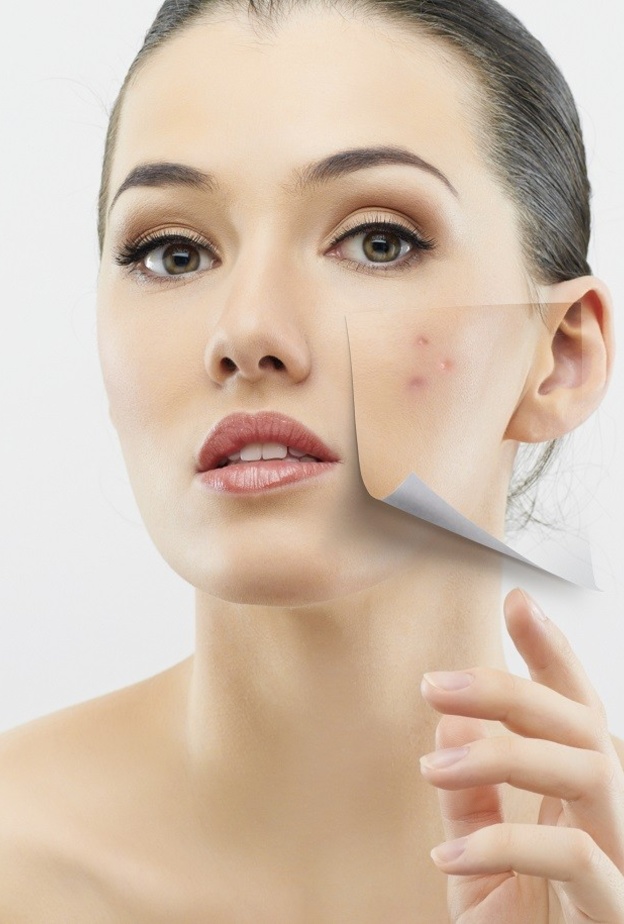 احصلي على بشرة خالية من أي عيوب من خلال الليزر الكربوني