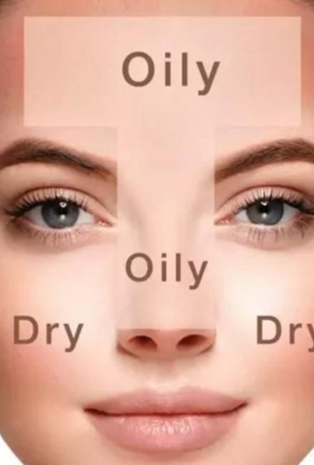 أنواع متعددة من البشرة تجمع نفس مشكلات حب الشباب والبثور فانتهي لذلك