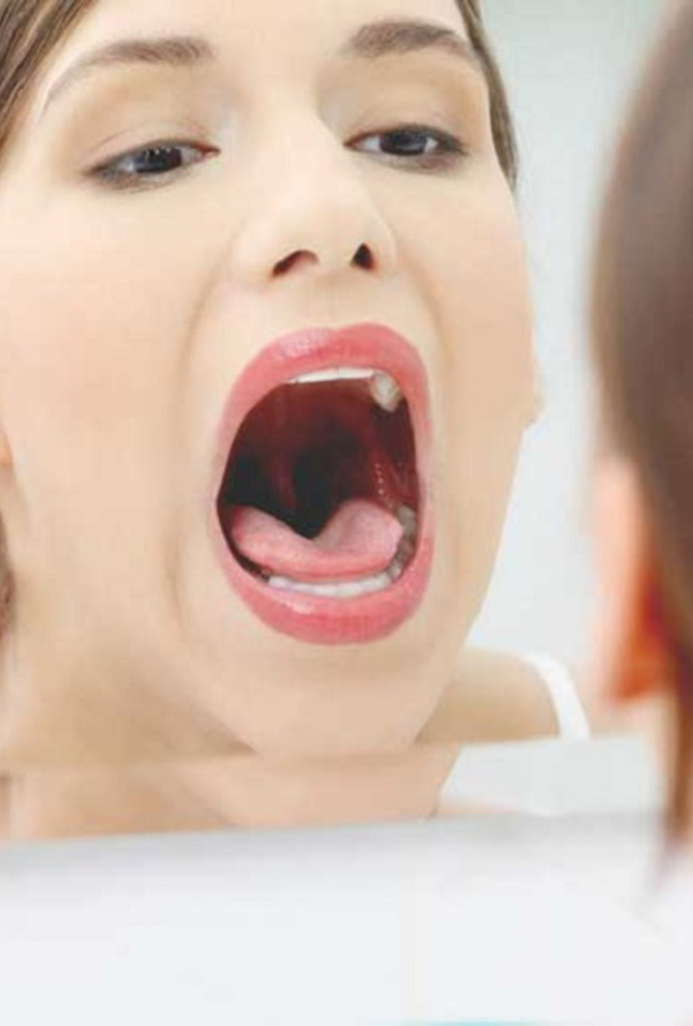 اللسان الجغرافي حالة صحية ليس لها مسبب مرضي