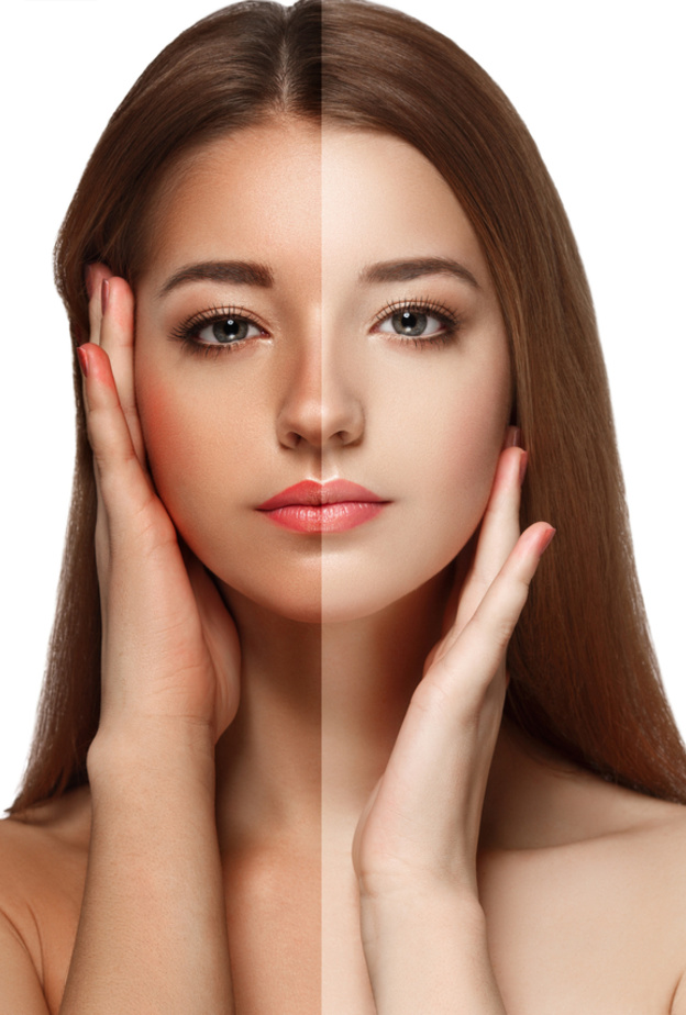 تسمير البشرة