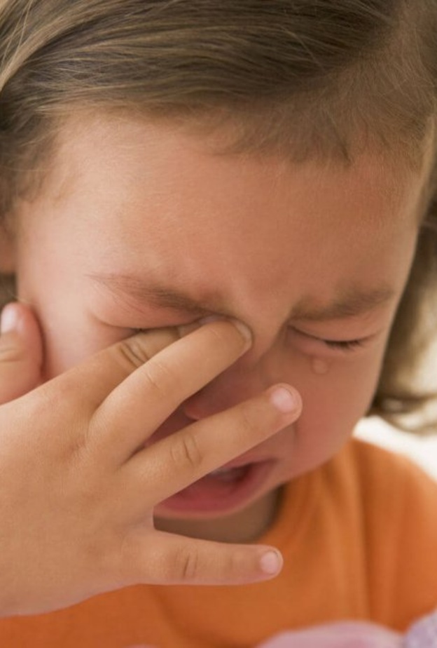 اسباب ظهور الهالات السوداء عند الاطفال وطرق علاجها