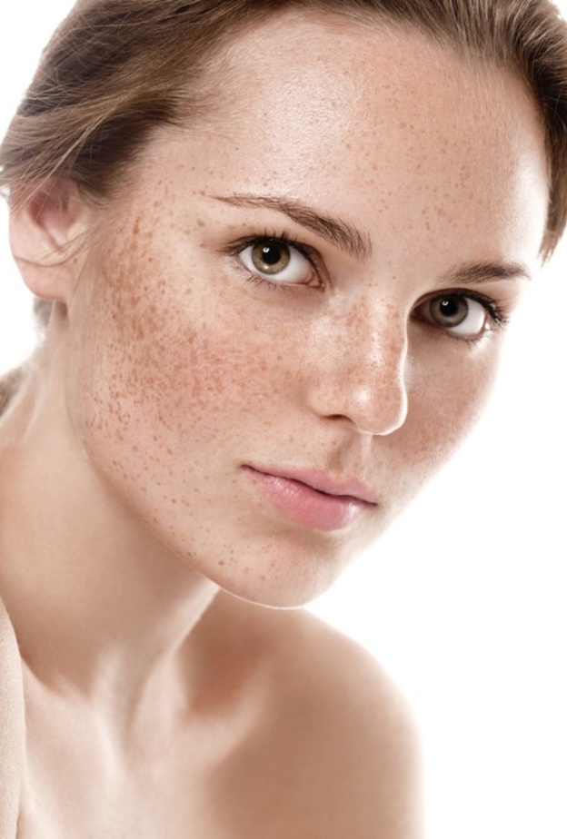 تعرفي على وصفات طبيعية للتخلص من الكلف والنمش