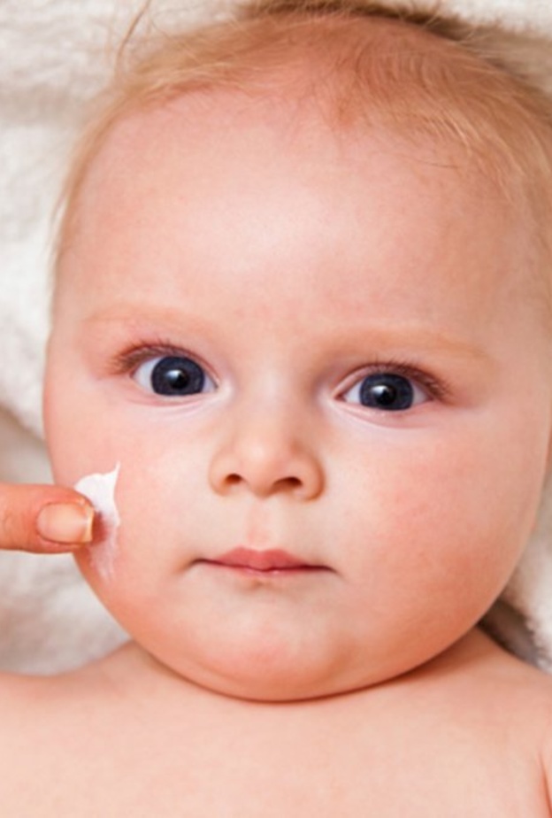 اسباب اكزيما الرضع