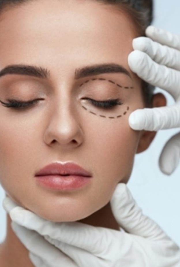 تجاعيد العين