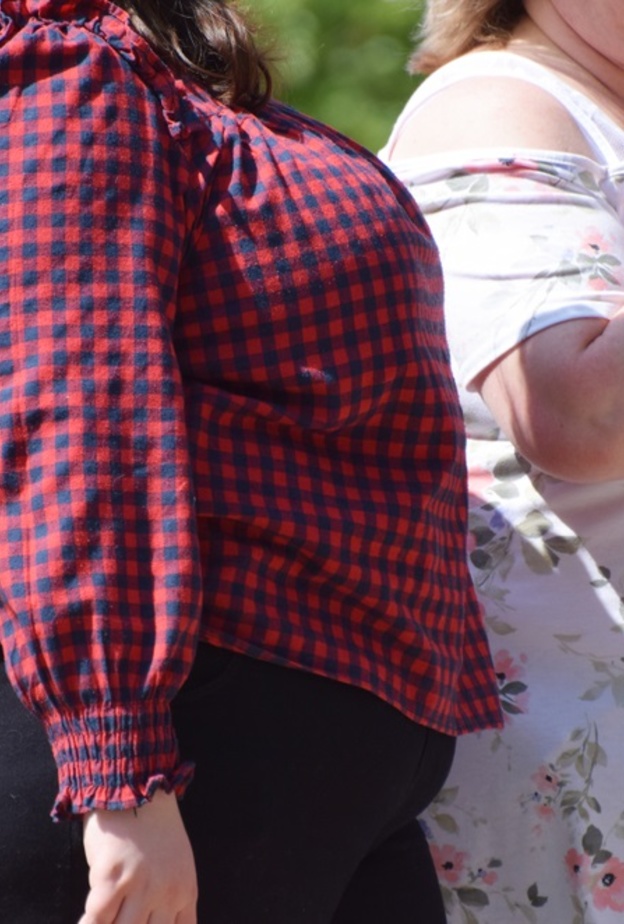  السمنة المرضية وعلاجها