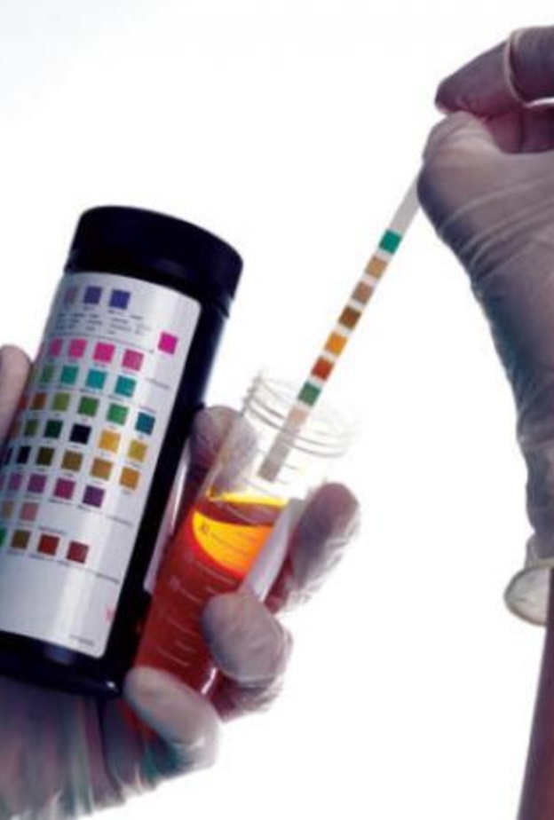  ارتفاع البوتين في البول دليل على الأمراض