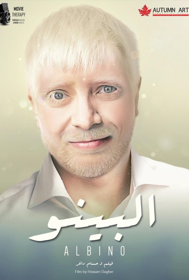 فيلم "البينو"