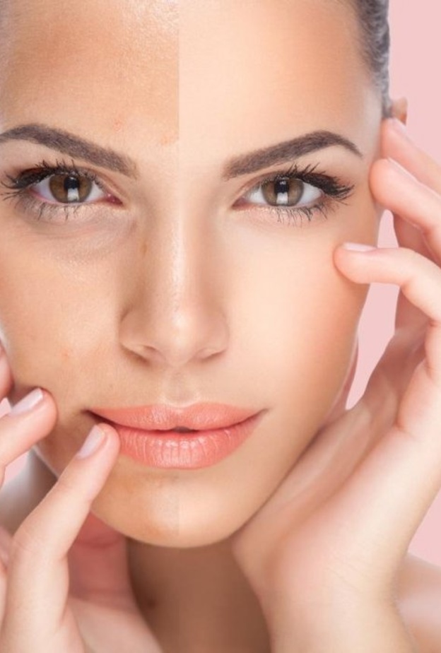 اضرار وفوائد تبييض البشرة بالليزر