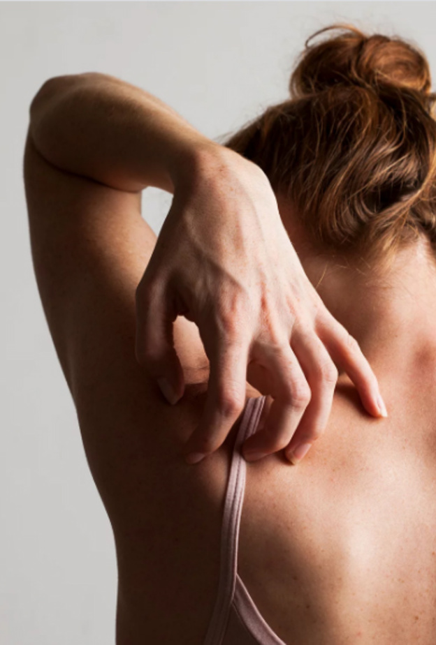 وصفات للتخلص من حبوب الظهر