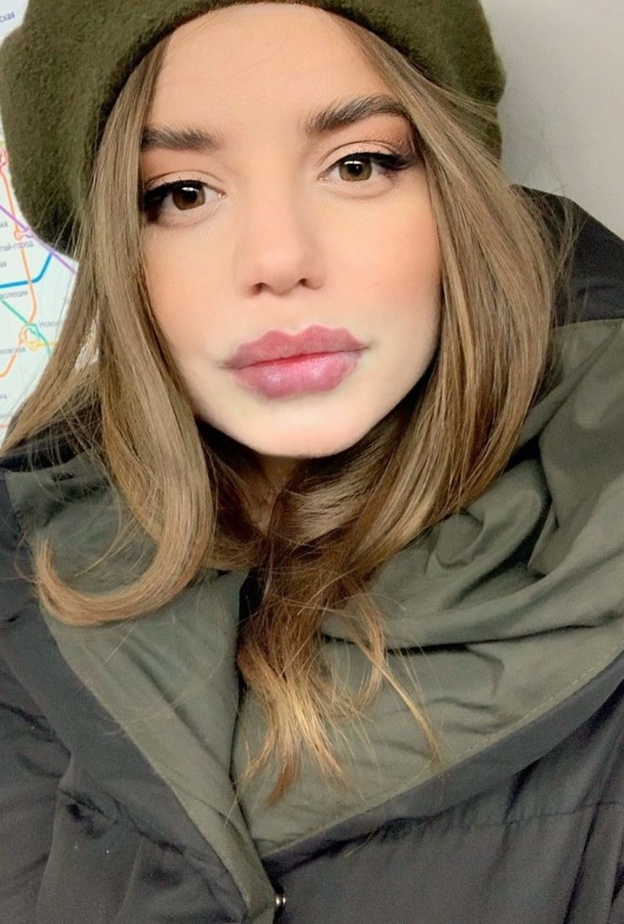 شفاه الأخطبوط تشمل إدخال حشو في الشفة الخارجية لإنشاء تأثير موجة عبر الشفتين