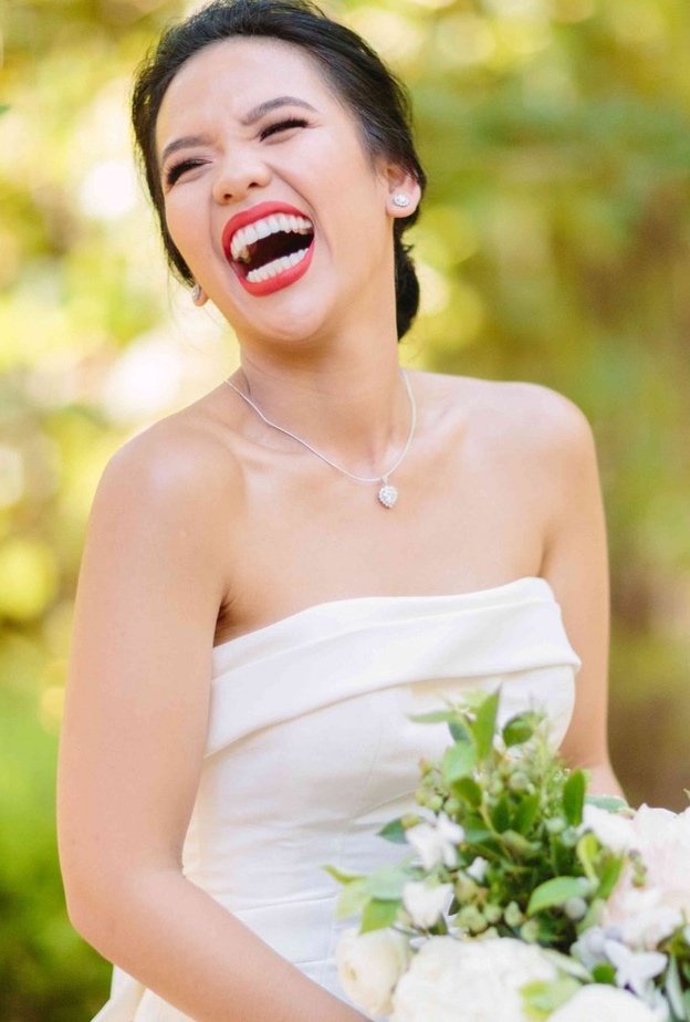 تبييض اسنان العروس