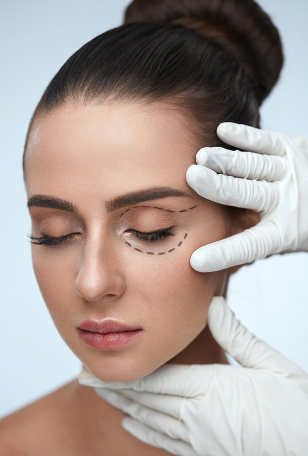 عملية جراحة الجفون