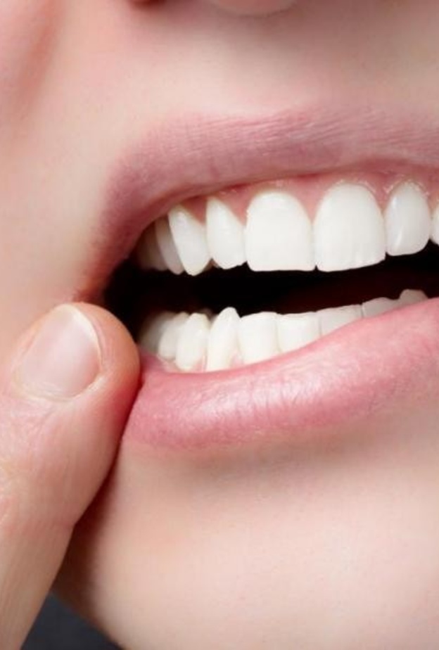 القلاع الفموي يسبب صعوبة في البلع