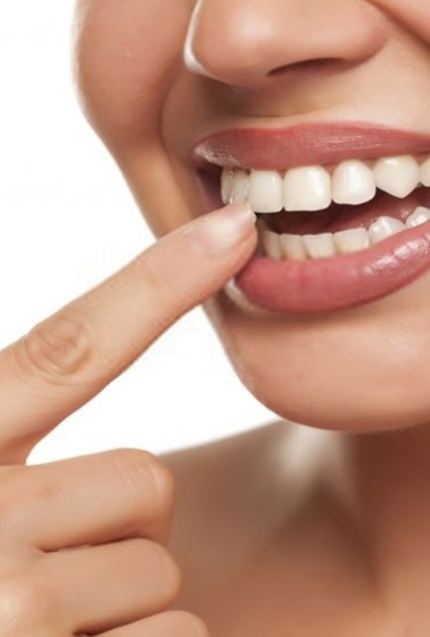 إجعلي أسنانك بيضاء بأطعمة تساعد على تبييض الأسنان