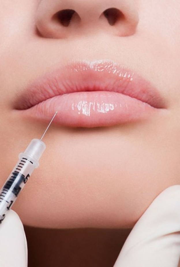 تجنبي إزالة شعر الوجه بالليزر أو أي وسيلة أخرى بعد ثلاثة أيام على الأقل من الحقن