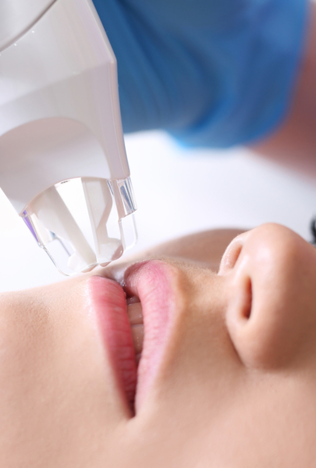 أصبح الليزر الحل الأكثر اعتماداً من قبل النساء والأطباء لتصغير الشفايف