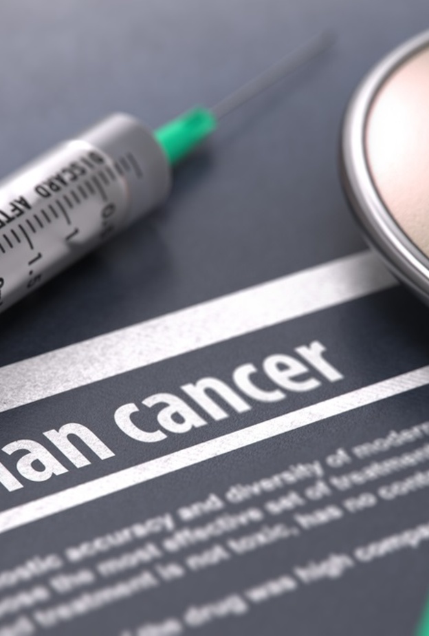 قرب تحديد منشأ سرطان المبيض عند النساء