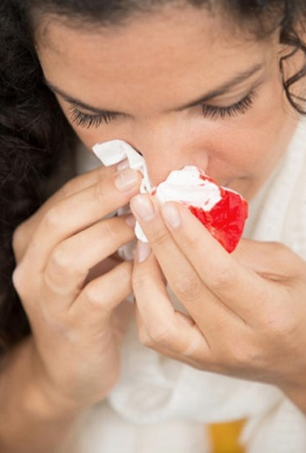  الإنحناء للأمام و ضغط الأنف أول خطوة لإسعاف نزيف الأنف