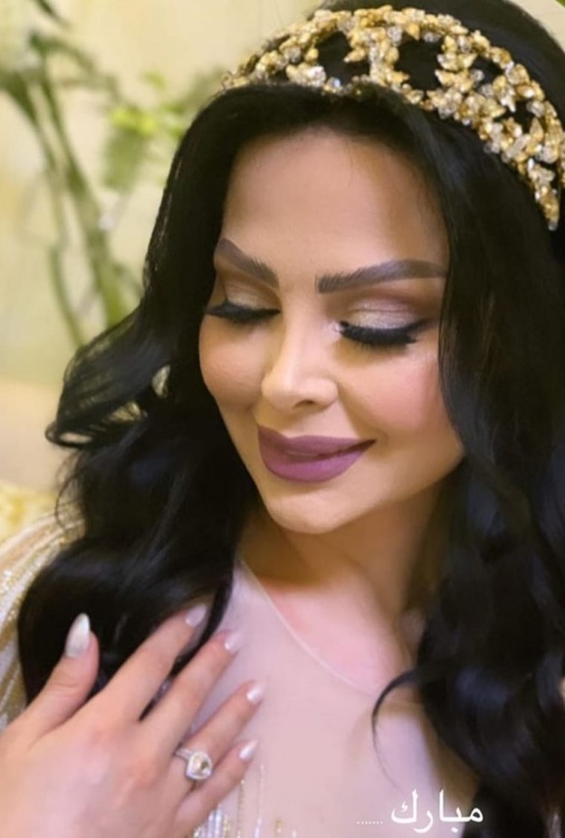 ديانا كرزون