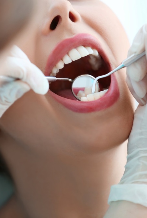 اسباب تسوس الاسنان عند الكبار وطرق الوقاية منها