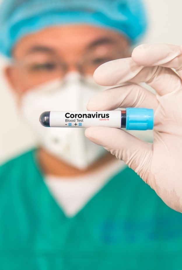 تحذير من سلالة اكثر شراسة لفيروس كورونا