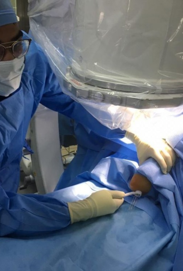 جراح سعودي يبتكر جهازا لتثبيت كسور الأطفال في دقائق